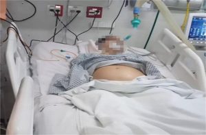 मरेकी आमाबाट भ्रूण निकाल्ने कि हुर्कन दिने भन्ने विषयमा अमेरिकामा बहस